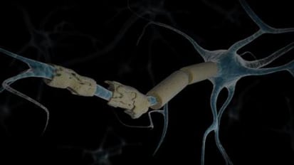 Exploring the Role of Immunosuppression in Autoimmunity for MS Patients Amid COVID-19