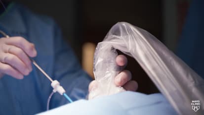 Mayo Clinic's approach to fetal surgery