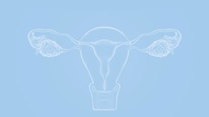 Hereditary Gynecologic Cancer Syndromes: When to Consider Genetic Counseling