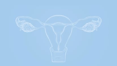 Hereditary Gynecologic Cancer Syndromes: When to Consider Genetic Counseling