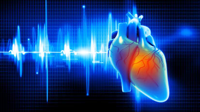 Subcutaneous Implantable Cardioverter Defibrillator, S-ICD