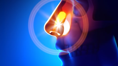 New Allergic Rhinitis Practice Guidelines