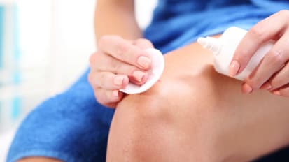 Case Study: V.A.C. VERAFLO™ Therapy and Advanced Wound Dressing