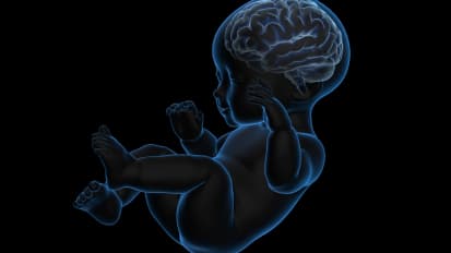 Endoscopic Intracranial Cyst Fenestration