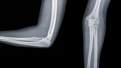Terrible Triad Injuries and the Complex Elbow: Anatomy and Biomechanics