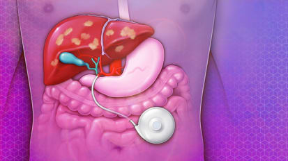 The Role of Locoregional and Systemic Therapies in the Management of Colorectal Liver Metastases