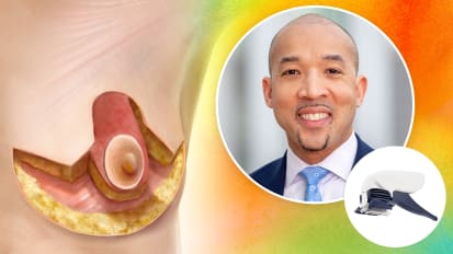 Increasing Efficiency, Clinical and Aesthetic Outcomes, and QoL in Reduction Mammoplasty