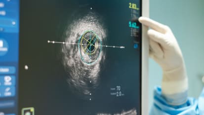 Power of Zero : Shaping Past, Present and Future of Cardiovascular Risk Assessment & Management