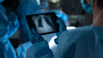 Interventional Pulmonology at Adventist Health Glendale