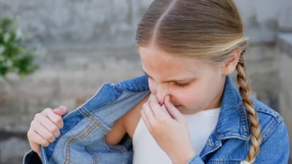 Surgical Cure for Axillary and Palmar Hyperhidrosis in Pediatric Patients