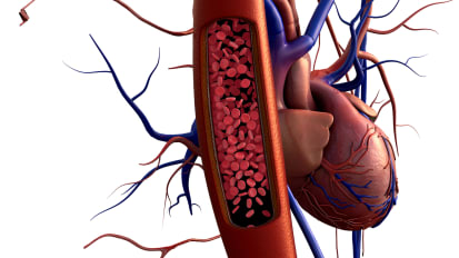 Aldosterone Receptor Inhibitors: Effective and Forgotten