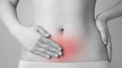 What Causes Endometriosis