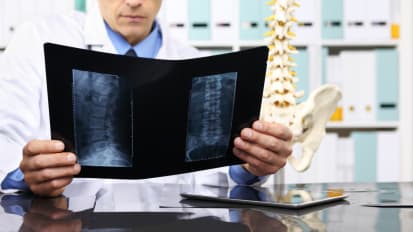 Spinal Surgical Planning