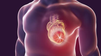 Hypertrophic Cardiomyopathy: What's All the HYPE?