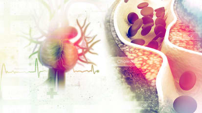 Angiotensin-Converting Enzyme Inhibitors