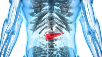 Advances in Immunotherapy for Pancreatic Cancer: Robert H. Vonderheide, MD, DPhil (Part 2)