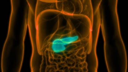 Pancreatic Head Resection for Localized Pancreatic Cancer