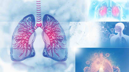 New Treatment Options for Lung Cancer - Kimmel Cancer Center Podcast Series