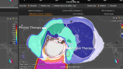 Differences in Proton and Photon Therapy, Johns Hopkins Medicine