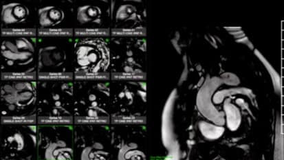 Multimodality Case Studies in Vascular Disease	