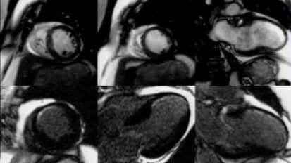 Latest Advances in CMR Techniques and Future Applications