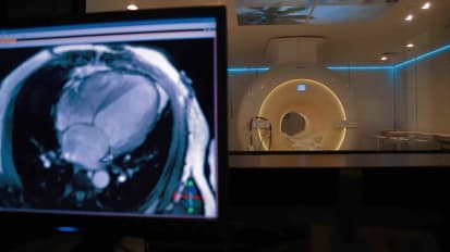 #TomorrowsDiscoveries: Cardiovascular Imaging