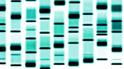 Q&A About the Use of Gene Transfer Therapy for the Treatment of Rare Pediatric Neurologic Disorders