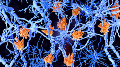 Multiple Sclerosis: MS Treatment Across the Lifespan – Overview from 2019 American Neurology Association Annual Meeting