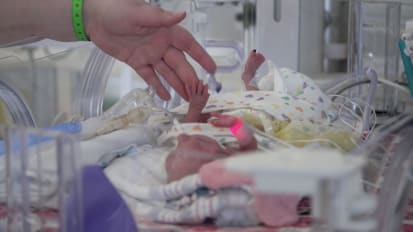 Catheter PDA closure for a 19-ounce preemie