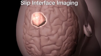 Slip interface imaging