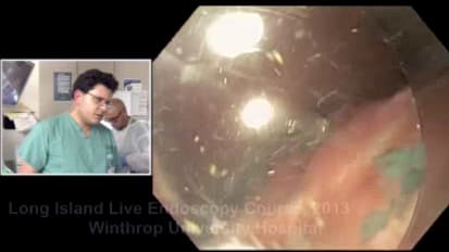 2013 LI Live Endoscopy Course: Live Cases Morning