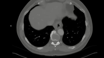 2016 LI Live: Live Endoscopic Procedures