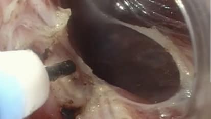 2017 LI Live- Live Cases Morning