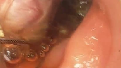 2017 LI Live- Live Cases Afternoon 1