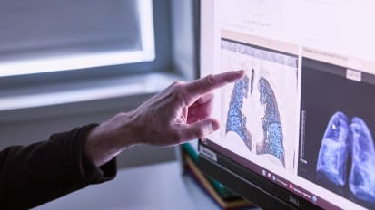 LDCT+: A New Approach in Early Lung Disease Detection - Webinar