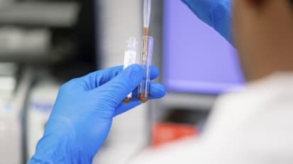 Hepatology and COVID-19: Liver Function Testing