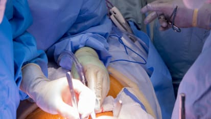 Getting Patients to Liver Transplant Before It's Too Late