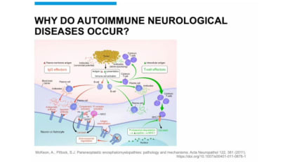 Autoimmune CNS disorders