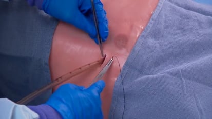 Securing a chest tube