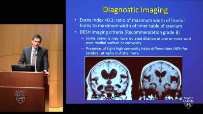 Adult-onset hydrocephalus