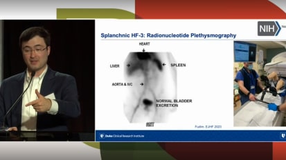 容量超载分布机制