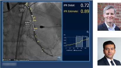 Patients with diffuse disease and renal dysfunction present challenging cases which require a variety of tools to successfully treat