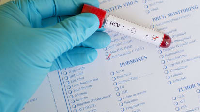 Oral Antiviral Agents for HCV