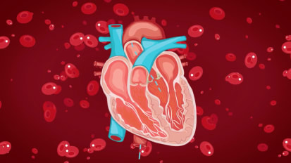 TAVR Aortic Valve Replacement for Aortic Stenosis Patients