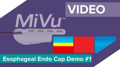 MiVu™ Esophageal Endo Cap Demonstration:1