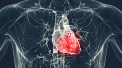 Currents in Myocarditis: A Fresh Look at Causes, Classification and Care