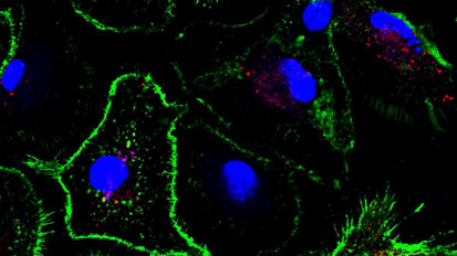 Nonalcoholic steatohepatitis (NASH) research at Mayo Clinic