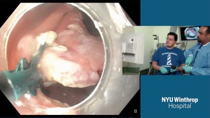 2018 LI Live: Live Endoscopic Procedures - Afternoon Part 1 of 2