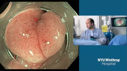 2018 LI Live: Live Endoscopic Procedures - Morning Part 2 of 2