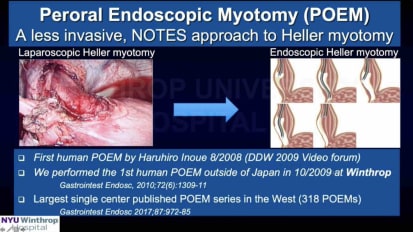 POEM vs Heller. A comprehensive review of the evidence